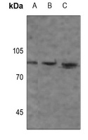 Beta-glucosidase 2 Rabbit Polyclonal Antibody