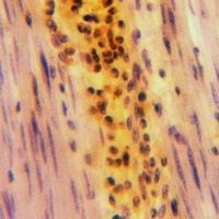 Beta-glucosidase 2 Rabbit Polyclonal Antibody