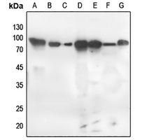 PKC zeta (Phospho-T560) Rabbit Polyclonal Antibody