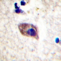 PKC zeta (Phospho-T560) Rabbit Polyclonal Antibody