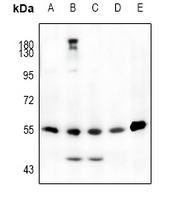 JNK1/2/3 (Phospho-T183) Rabbit Polyclonal Antibody