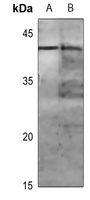 MKK1 (Phospho-T286) Rabbit Polyclonal Antibody
