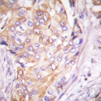 MKK1 (Phospho-T286) Rabbit Polyclonal Antibody