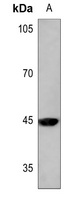 MKK1 (Phospho-T292) Rabbit Polyclonal Antibody
