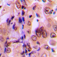 MKK1 (Phospho-T292) Rabbit Polyclonal Antibody