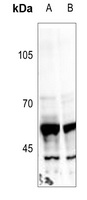 Peripherin Rabbit Polyclonal Antibody