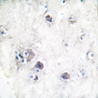 Peripherin Rabbit Polyclonal Antibody