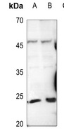 Trypsin 1 Rabbit Polyclonal Antibody