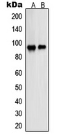 PSMD2 Rabbit Polyclonal Antibody