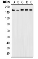 Patched Rabbit Polyclonal Antibody