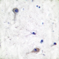 Patched Rabbit Polyclonal Antibody