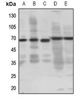 EP4 Rabbit Polyclonal Antibody