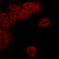 EP4 Rabbit Polyclonal Antibody