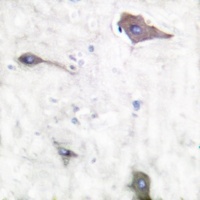 PGHS-1 Rabbit Polyclonal Antibody