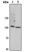 Focal Adhesion Kinase (Phospho-Y861) Rabbit Polyclonal Antibody