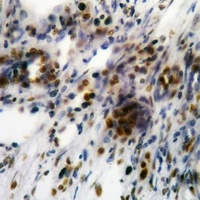 Focal Adhesion Kinase (Phospho-Y861) Rabbit Polyclonal Antibody