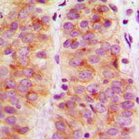 Focal Adhesion Kinase Rabbit Polyclonal Antibody