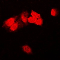 Focal Adhesion Kinase Rabbit Polyclonal Antibody