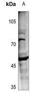 MOK Rabbit Polyclonal Antibody