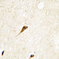 MOK Rabbit Polyclonal Antibody