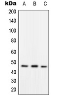 RAD52 (Phospho-Y104) Rabbit Polyclonal Antibody