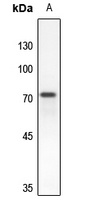 RAP1GAP Rabbit Polyclonal Antibody
