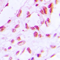 RB1 (Phospho-S780) Rabbit Polyclonal Antibody