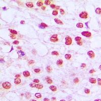 RB1 Rabbit Polyclonal Antibody