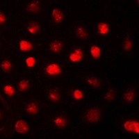 RB1 Rabbit Polyclonal Antibody