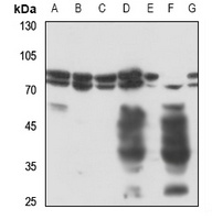 Radixin Rabbit Polyclonal Antibody