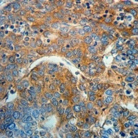 Radixin Rabbit Polyclonal Antibody