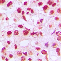 c-Rel Rabbit Polyclonal Antibody