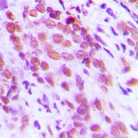 NF-kappaB p65 (Phospho-S276) Rabbit Polyclonal Antibody