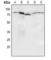 NF-kappaB p65 (Phospho-S536) Rabbit Polyclonal Antibody