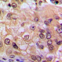NF-kappaB p65 Rabbit Polyclonal Antibody