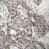 RPL3 Rabbit Polyclonal Antibody