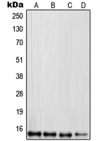 RPL30 Rabbit Polyclonal Antibody
