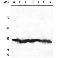 RPS2 Rabbit Polyclonal Antibody