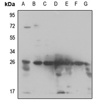 RPS3 Rabbit Polyclonal Antibody