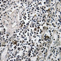 RPS3 Rabbit Polyclonal Antibody