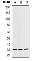 RPS4X Rabbit Polyclonal Antibody