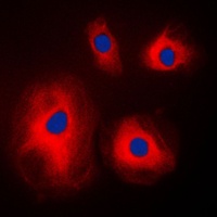 RPS4X Rabbit Polyclonal Antibody