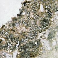 RSK1 (Phospho-S380) Rabbit Polyclonal Antibody