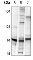 S6K1 (Phospho-S418) Rabbit Polyclonal Antibody