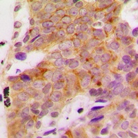 S6K1 (Phospho-S418) Rabbit Polyclonal Antibody