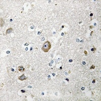 RPS9 Rabbit Polyclonal Antibody