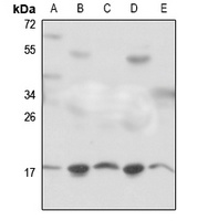 RPS18 Rabbit Polyclonal Antibody