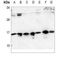 RPS19 Rabbit Polyclonal Antibody