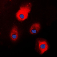 S100-A1 Rabbit Polyclonal Antibody