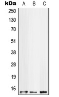 S100-A10 Rabbit Polyclonal Antibody